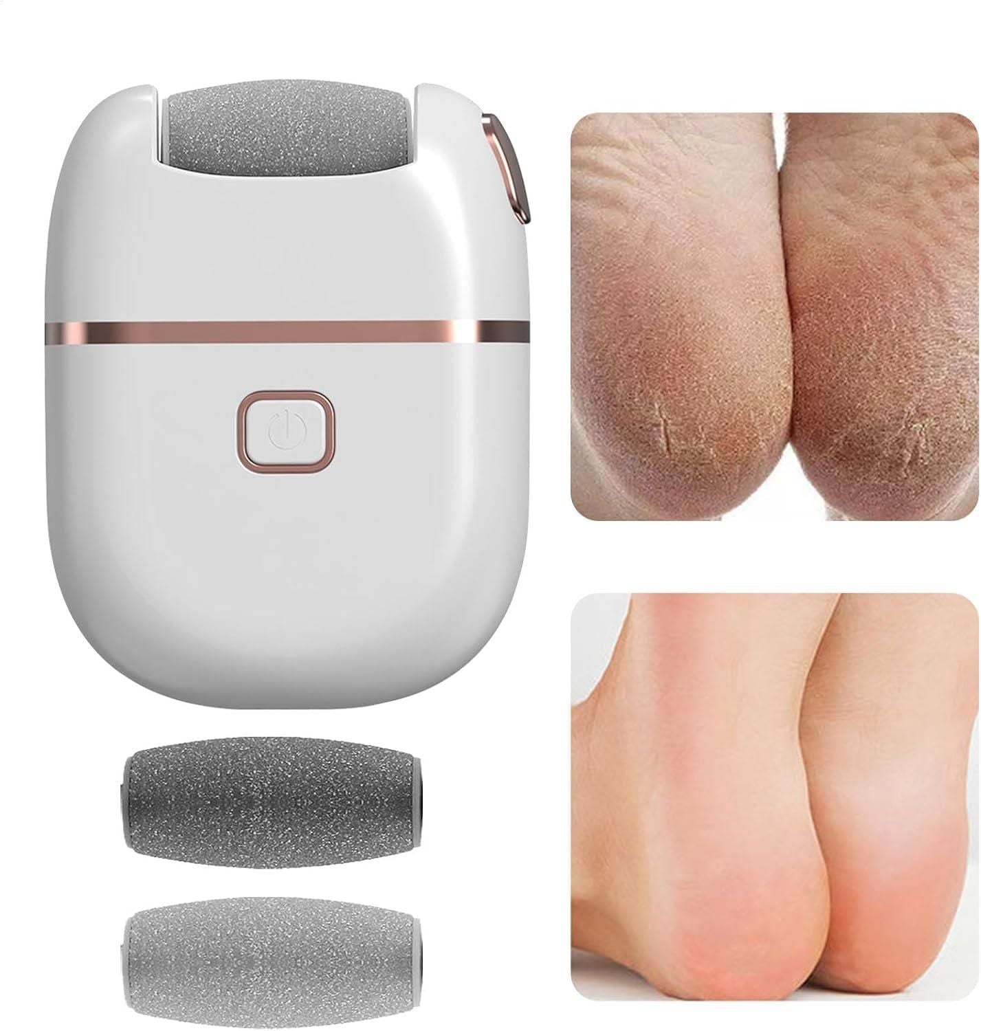 Electronic Pedicure Tool c5fu54-ny