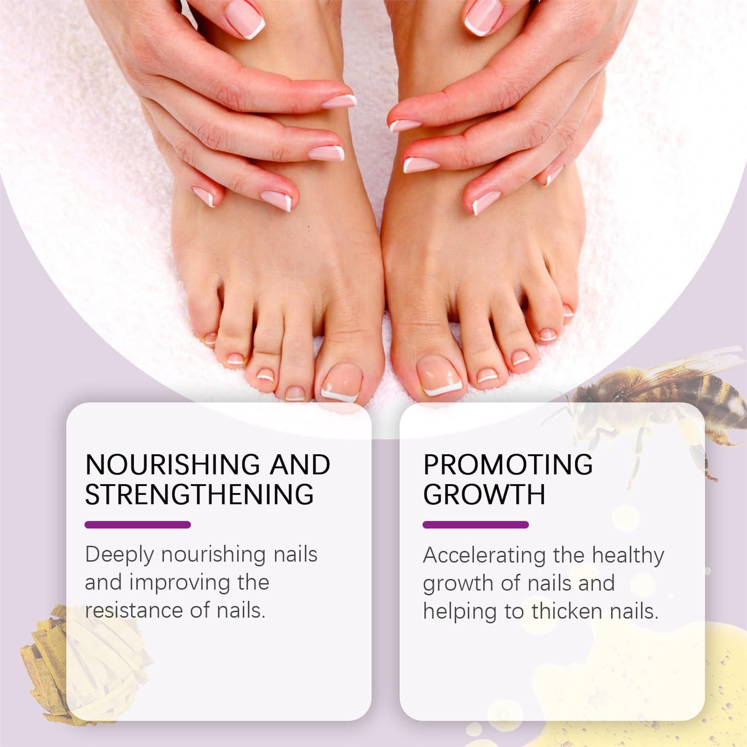 Fungi Free Bee Venom Nail Treatment Solution Serum (15ml) c5fu54-ny